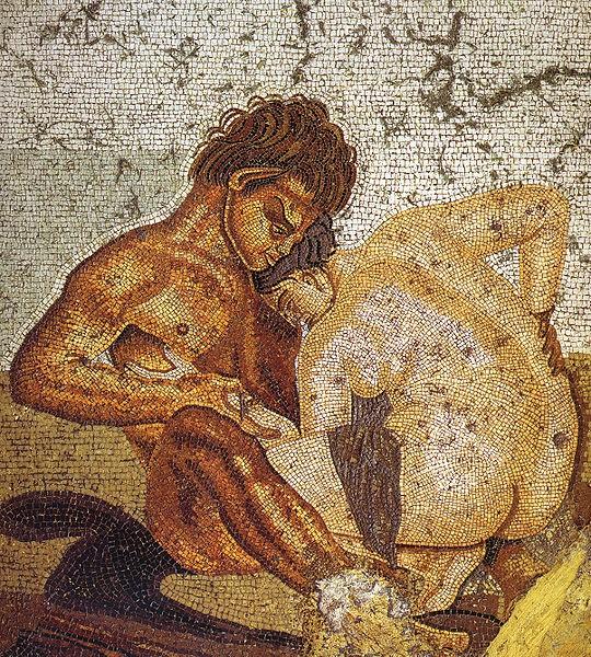 Siğiller eski Roma'dan beri bilinene cinsel temasla geçen hastalıklardır. 