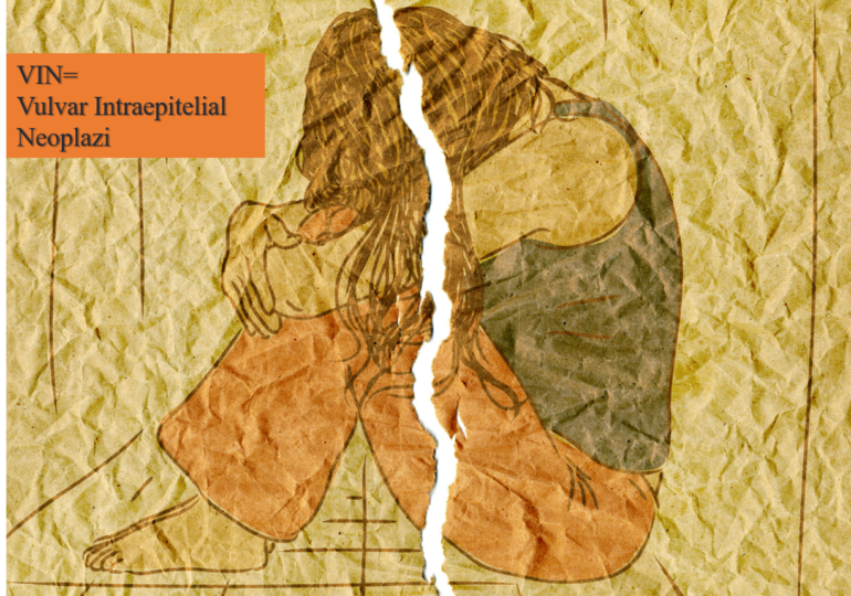 VIN = Vulvar Intraepithelial Neoplasia: What is it? How is it Classified? VIN = Vulvar Intraepithelial Neoplasia: What is it? How is it Classified?