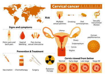 Prevalence and World Distribution of Cervical Cancer